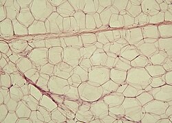 Imagen por microscopía óptica de un corte de tejido adiposo blanco subcutáneo.