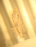 Piojo humano bajo microscopio