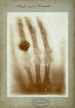 Primera radiografía médica de la mano de Anna Bertha Ludwig