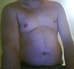 Grasa abdominal en un adolescente masculino.