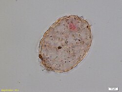Amphitrema stenostoma