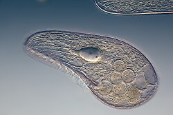 Blepharisma, un ciliado de vida libre observado al microscopio.