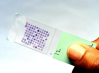 Una micromatriz de ADN utilizada en experimentos de expresión génica.