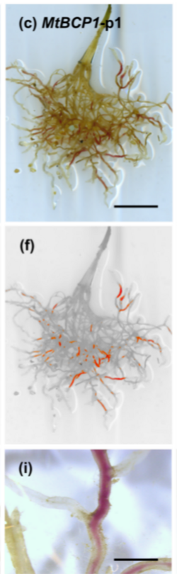 Micrografía que muestra micorriza Rhizophagus irregularis en raíces.