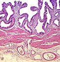 Micrografía óptica mostrando tinción diferencial en tejidos biológicos