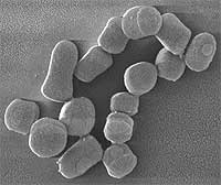 Micrografía e ilustración taxonómica de Arthrobacter