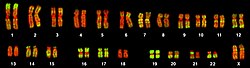 Imagen de microscopía fluorescente de un cariotipo humano
