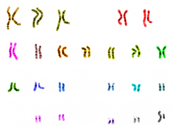 Representación de los 46 cromosomas que forman el genoma diploide de un varón humano