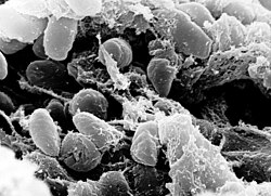 Imagen al microscopio electrónico de barrido que muestra una aglomeración de Yersinia pestis.