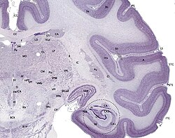 Sección coronal de cerebro de macaco teñida con Nissl.