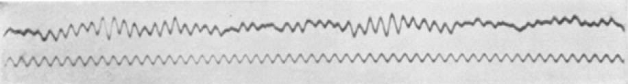 Primer registro publicado de un electroencefalograma en humano por Hans Berger en 1929.