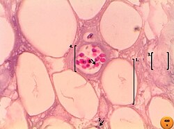 Tejido adiposo visto al microscopio óptico con aumento de 400x