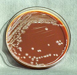 Colonias de Yersinia pestis en agar chocolate.