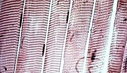 Estríación del miocito mostrada por microscopía óptica.