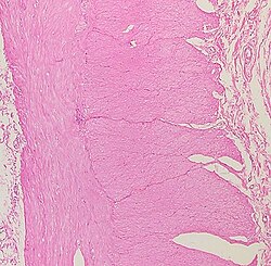 Sección histológica de la pared colónica observada bajo microscopio óptico con tinción de HE.