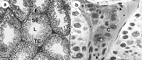 Micrografía óptica que muestra el compartimento intersticio y las células de Leydig.
