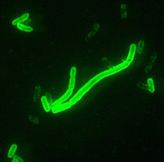 Yersinia pestis, bacteria causante de la peste vista con un microscopio de fluorescencia.