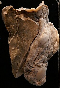 Pulmones en exhibición