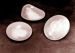 Implantes mamarios de silicona como ejemplo de biomaterial.