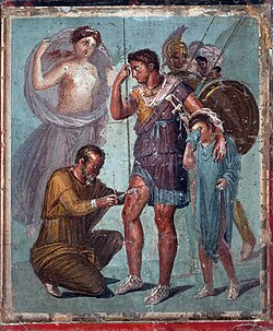 Yápige extrayendo una punta de flecha de la pierna de Eneas junto a Ascanio y Venus