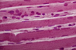 Microfotografía de fibras musculares esqueléticas