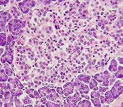 Vista microscópica de un islote rodeado por tejido acinar.