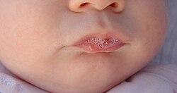 Saliva visible en los labios de un bebé
