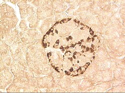 Immunohistoquímica de estreptavidina-biotina para detectar glucagón