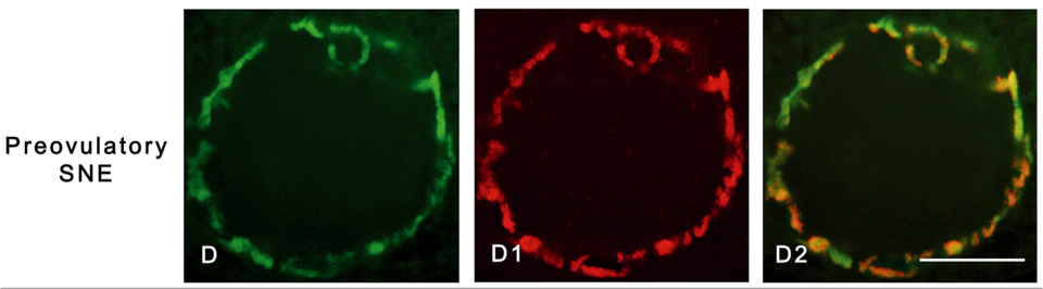Cromatina condensada en la membrana del núcleo de un ovocito preovulatorio.