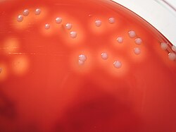Cultivo de Staphylococcus aureus en agar sangre