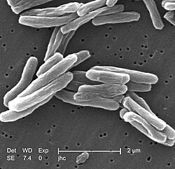 Microfotografía óptica que muestra la morfología de Mycobacterium tuberculosis.