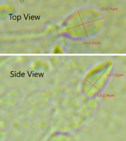 Dimensiones y aspecto microscópico de la cabeza del espermatozoide