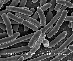 Micrografía de células de Escherichia coli