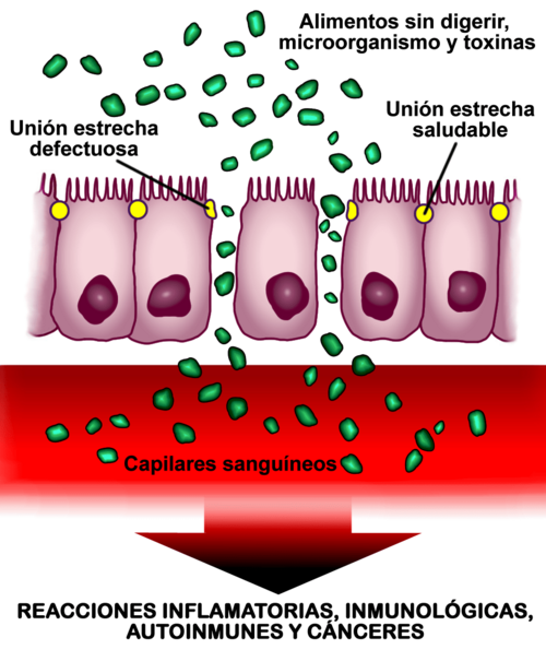 Esquema de la pared intestinal con permeabilidad aumentada