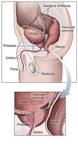 Esquema anatómico que muestra la próstata y su ubicación en relación con la vejiga y el recto.