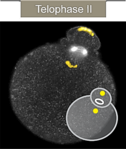 Microfotografía confocal del segundo corpúsculo polar con cromosomas destacados en amarillo.