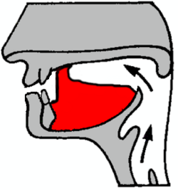 Diagrama de una oclusiva retrofleja subapical