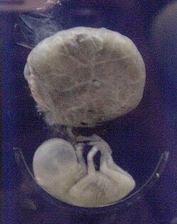 Ilustración de un feto humano unido a la placenta a los tres meses de edad gestacional.