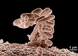 Micrografía electrónica de un cúmulo de bacterias E. coli