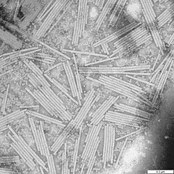 Micrografía electrónica del virus del mosaico del tabaco