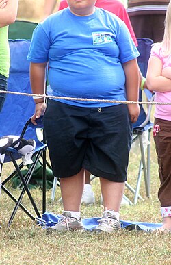 Representación de un niño con sobrepeso u obesidad infantil.