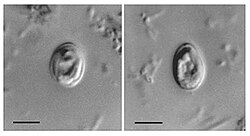 Micrografía de Cryptosporidium muris