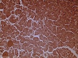 Microfotografía de tejido pancreático de perro ampliado cien veces.