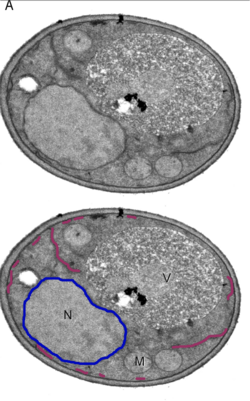 Microfotografía electrónica de una célula de levadura mostrando núcleo, mitocondrias y vesículas.
