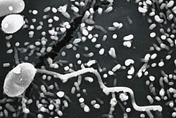 Encephalitozoon cuniculi