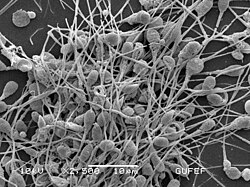 Microscopía electrónica de barrido de espermatozoides