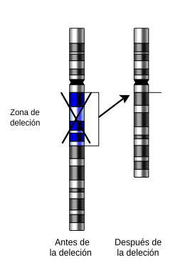 Representación esquemática de la deleción de un segmento en un cromosoma.