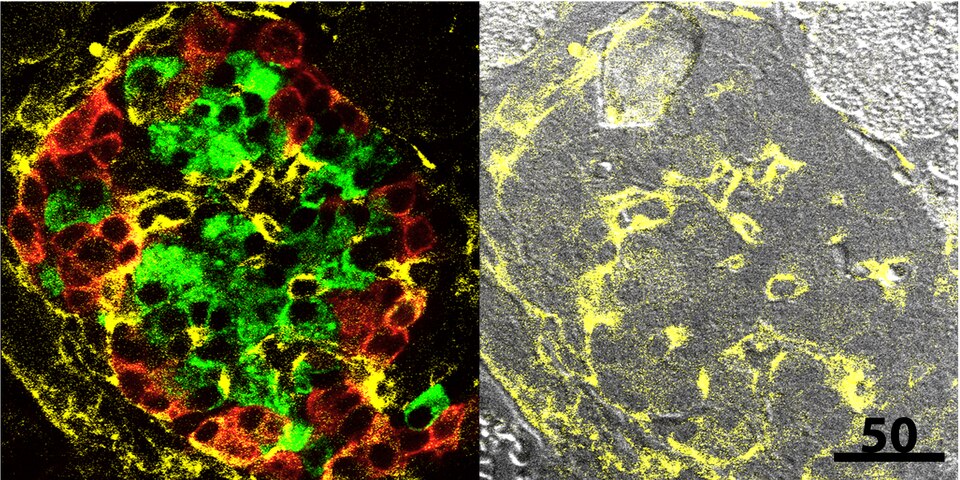 Inmunohistoquímica confocal de un islote pancreático mostrando células alfa y beta.