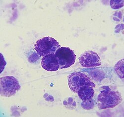 Mastocitos cargados de gránulos de histamina visualizados microscópicamente.