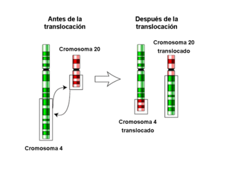 Translocación recíproca entre los cromosomas 4 y 20 en humanos.